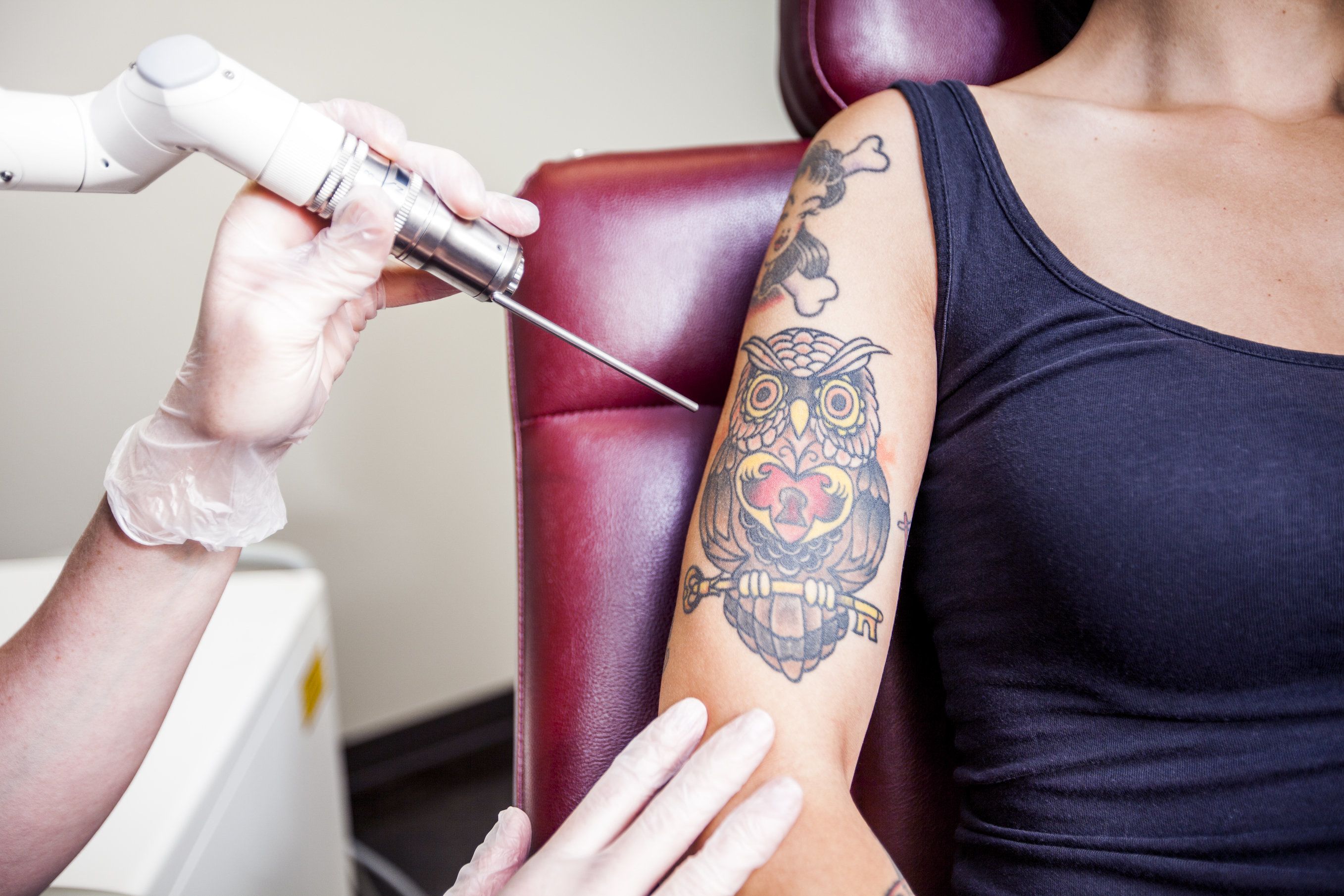 Woman wearing a blue tank top about to undergo laser tattoo removal.